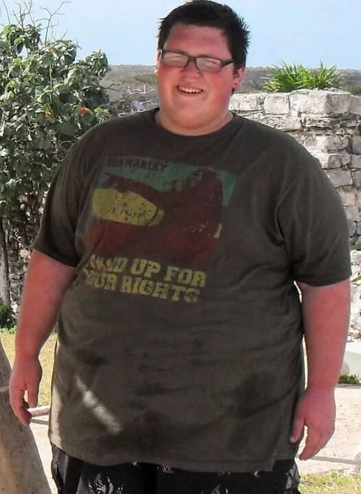 Perteklinis svoris prieš naudojant „Keto Probiotix“